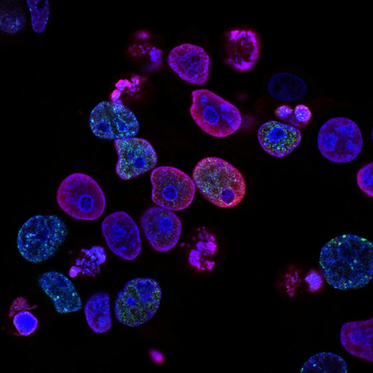 Cellule eucaryote et procaryote au microscope